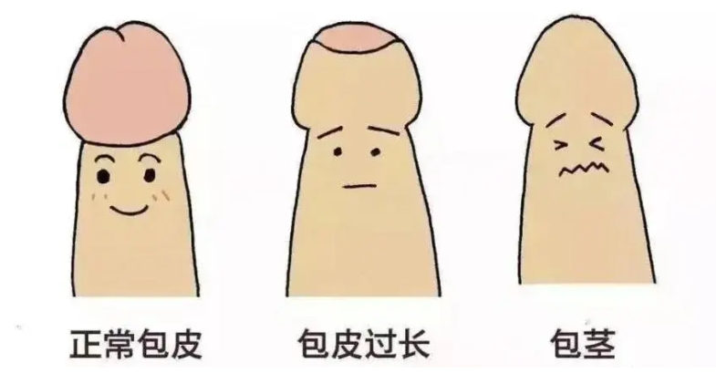 慈利县妇幼保健院暑期JJ手术专场来了